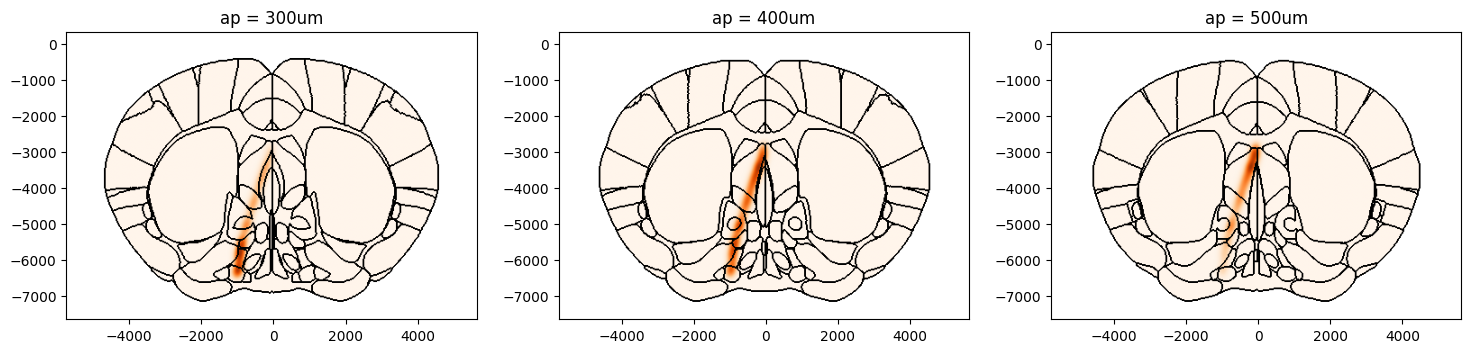 ../_images/notebooks_external_atlas_plotting_points_on_slice_15_1.png